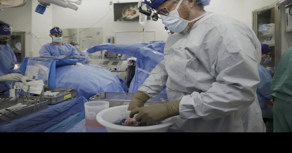 Pig kidney works in a donated body for over a month, a step toward ...