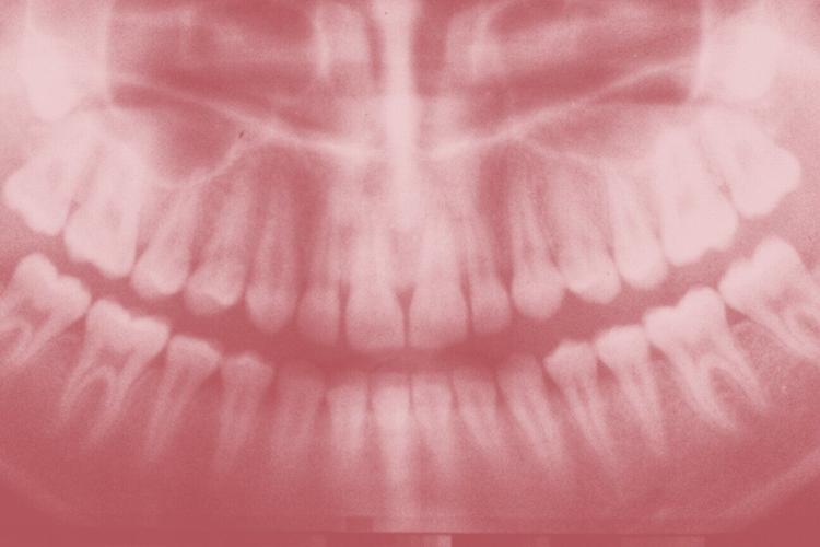 Losing-teeth-unsplash-web.jpg