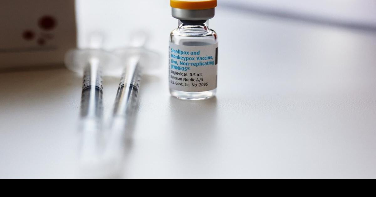 The history of the name ‘monkeypox’ — and why it’s being changed to ‘mpox’