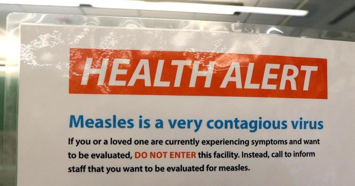 Toronto Public Health confirms second case of measles in 2024
