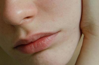 ozempic-skin-pexels.jpg