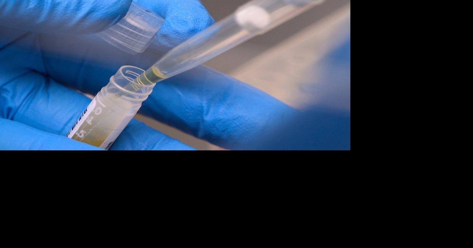 NIH funding cuts have affected over 74,000 people enrolled in experiments, a new report says