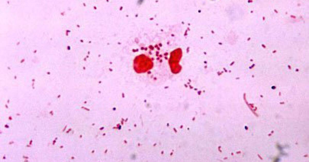 First Chlamydia Herpes Rates Released In Study first-chlamydia-herpes-rates-released-in-study