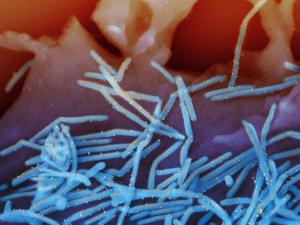 Experts make new recommendations on RSV and meningitis vaccines, but it