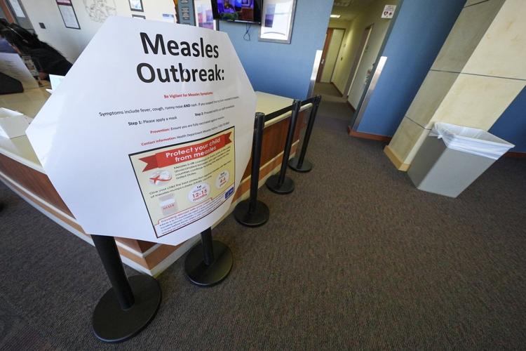 Second child died from measles-related causes in West Texas, where cases are nearing 500