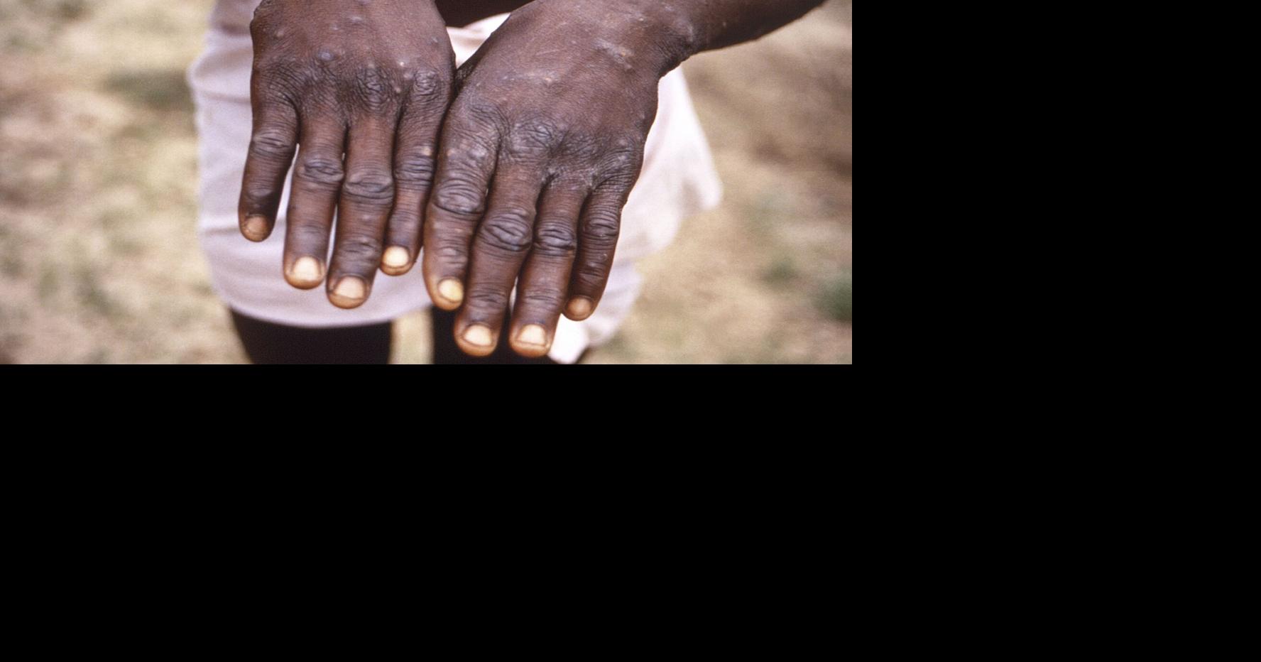 What’s happening in Africa and in Canada