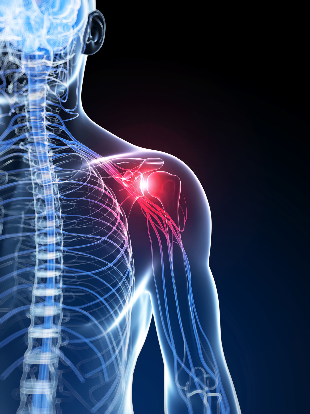 Rotator Cuff Tendonitis - The Lakes Physio