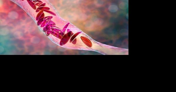Sickle Cell awareness walk on Saturday - Vimarsana News