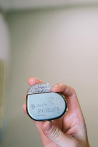 MUSC uses electrical stimulation to treat debilitating gastroparesis