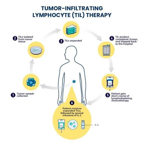 A treatment years in the making: Hollings’ first TIL therapy infusion