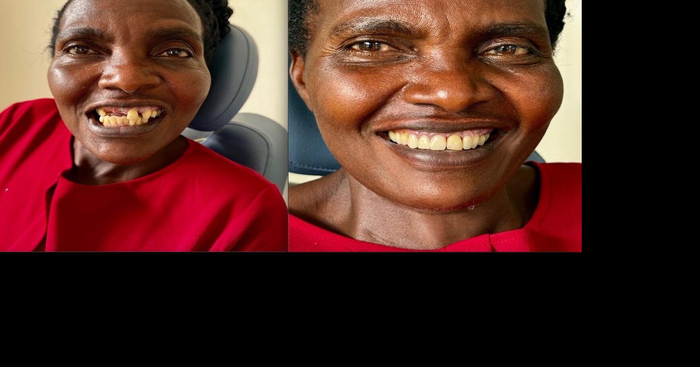 Local 49er Rotary and dentists restore smiles in Uganda