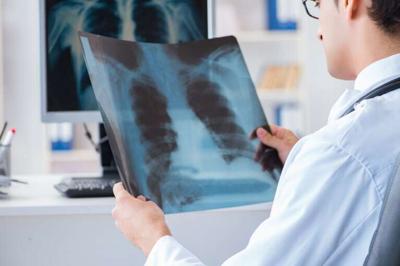 Screening Offers Best Tool in Fight Against Lung Cancer