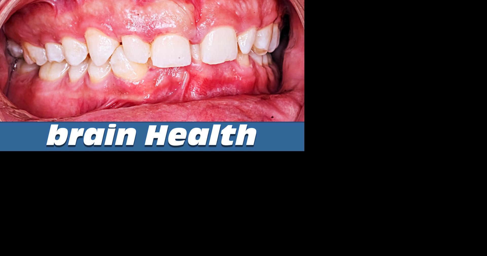 Health Alert Arlington: Gum Disease and Teeth Health Impact Your Brain