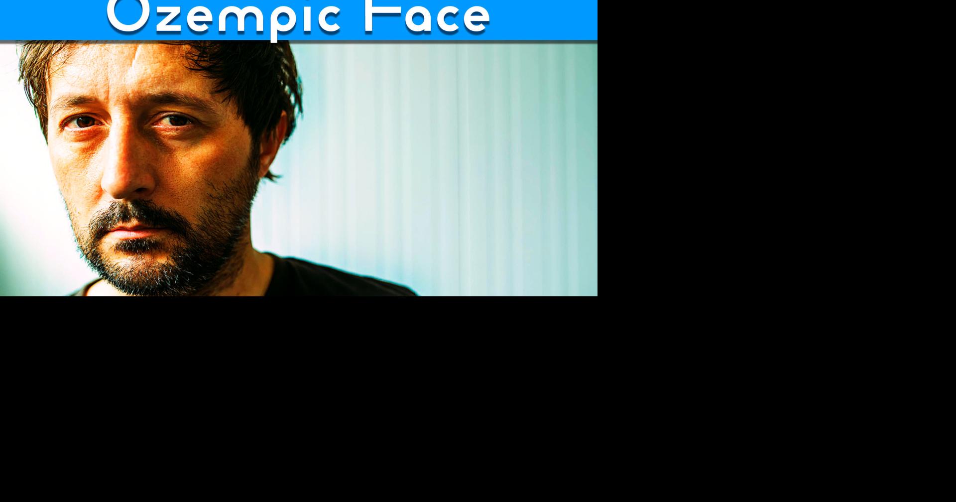 Ozempic Face showing up in Tuscaloosa? Doctor Explains | Latest Alabama