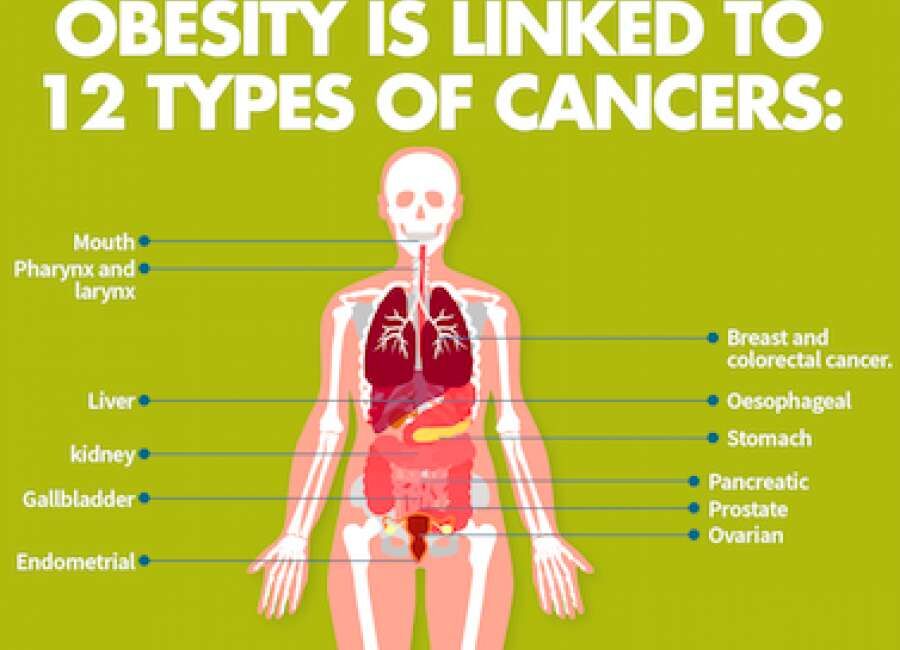 Obesity linked to 12 types of cancer | Health | times-herald.com