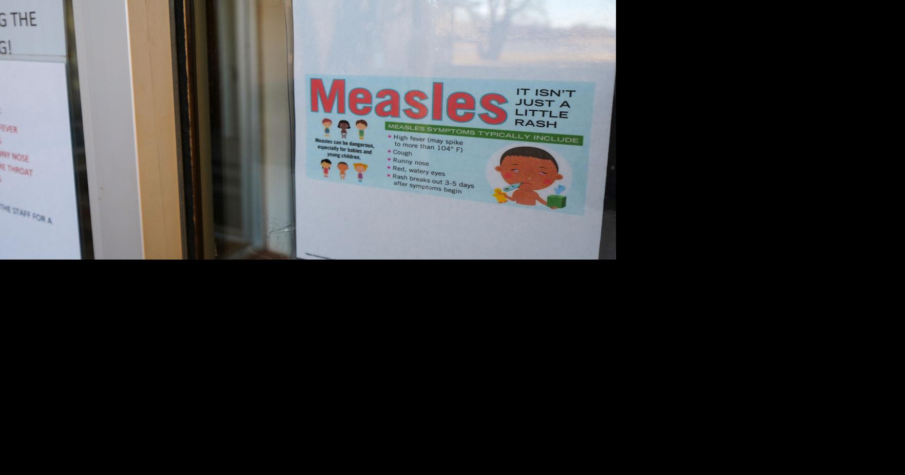 South Carolina measles outbreak surpasses Texas…