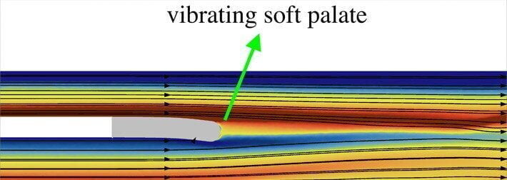 Loud snoring could be reduced thanks to high tech breakthrough