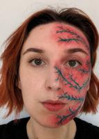 ‘Suicide disease’ more painful than childbirth leaves woman unable to kiss husband