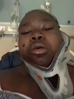 Shamiyah Laney survives gunshot wound to jaw