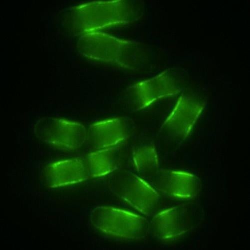 Scientists discover ‘switch’ to unlock longer lifespans after studying worms