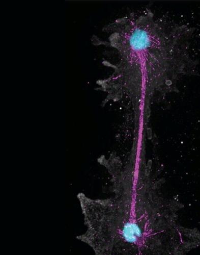 Tiny creature thrives at scalding temperatures that would kill all other known life