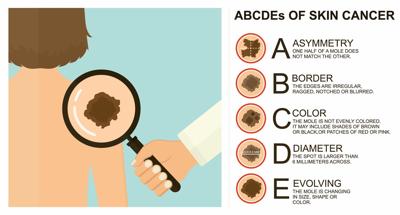 Medical professionals recognize Skin Cancer Awareness Month