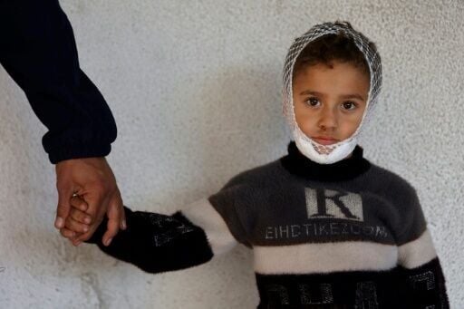 An injured Palestinian injured child at the Medecins Sans Frontieres clinic in al-Rimal in the Gaza Strip