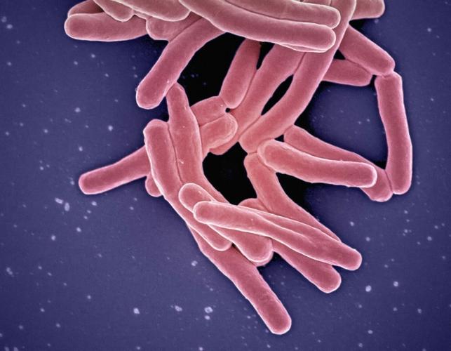 national-institute-of-allergy-and-infectious-diseases-K1ZoXdpWUNY-unsplash
