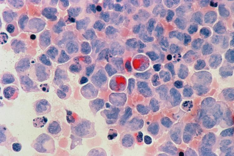 national-cancer-institute-mbL91Lg56zc-unsplash (2)