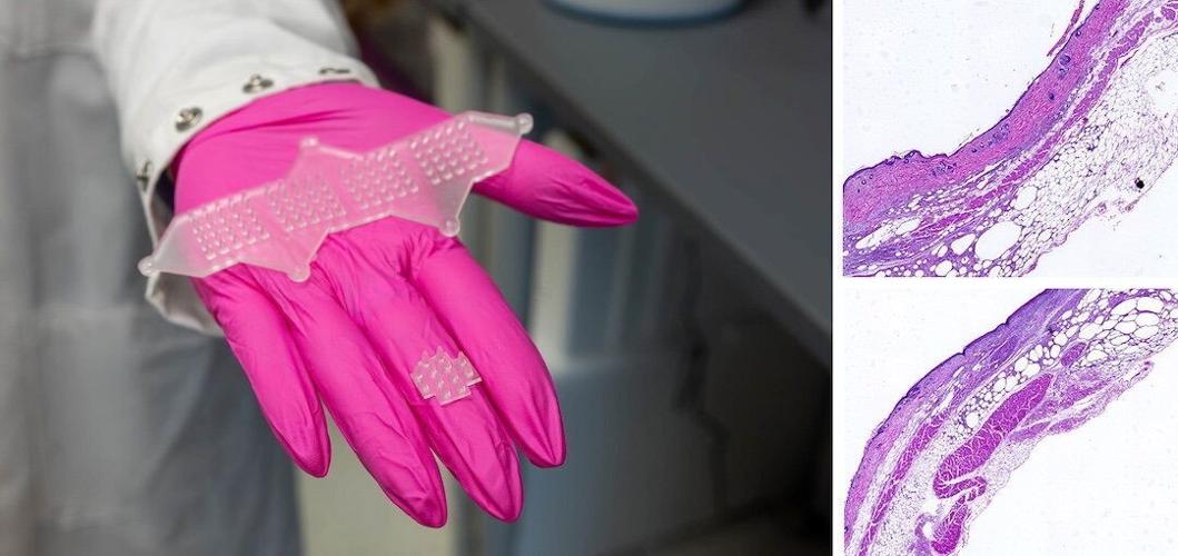 New “living bandage” accelerates healing of wounds