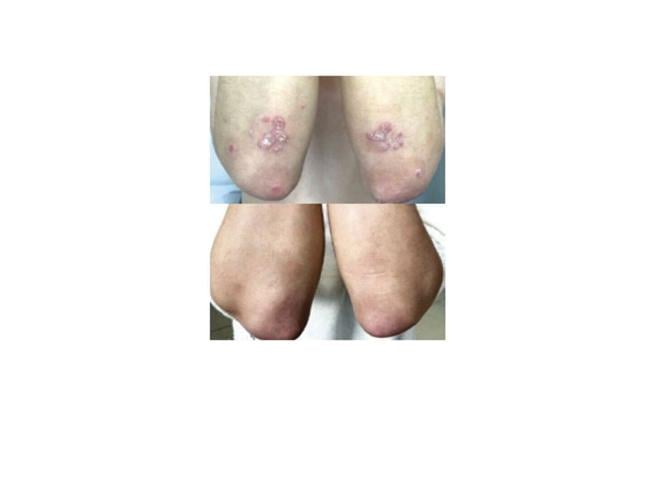 skincure_featured