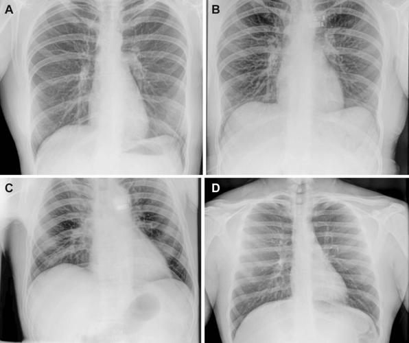Medical X-rays taken in space for the first time