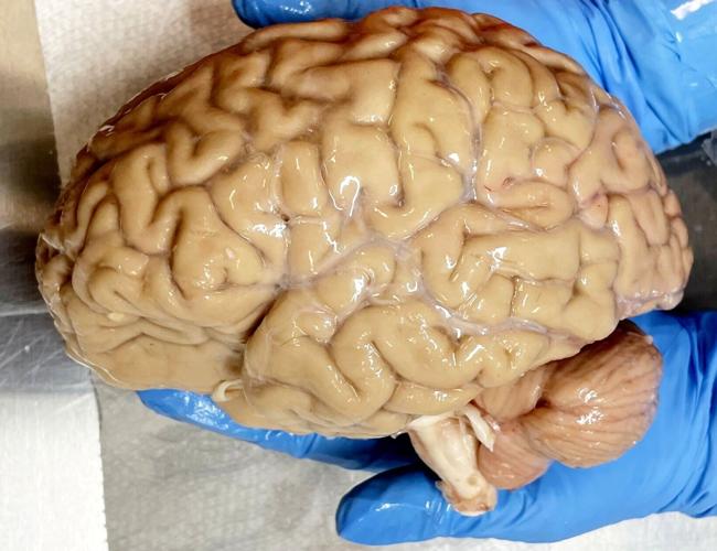 Deep freezing humans for the future has one in four chance of working, say doctors