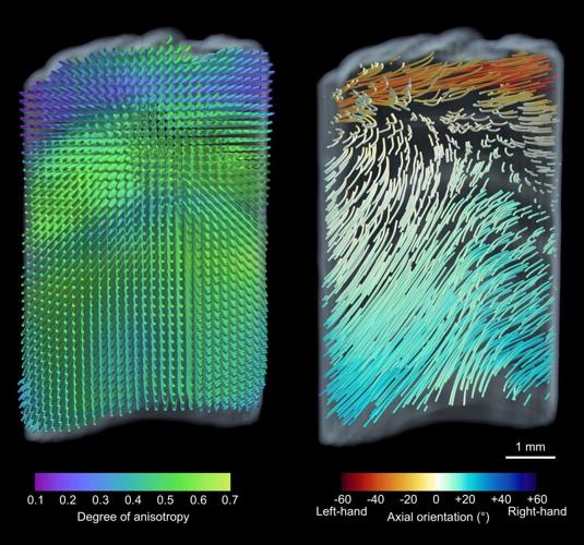 Hidden secrets of the narwhal’s twisted tusk revealed using X-ray technology