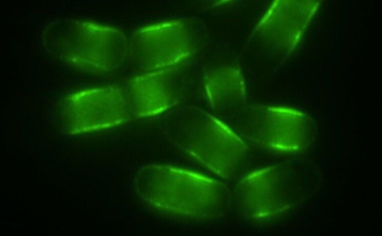 Scientists discover ‘switch’ to unlock longer lifespans after studying worms