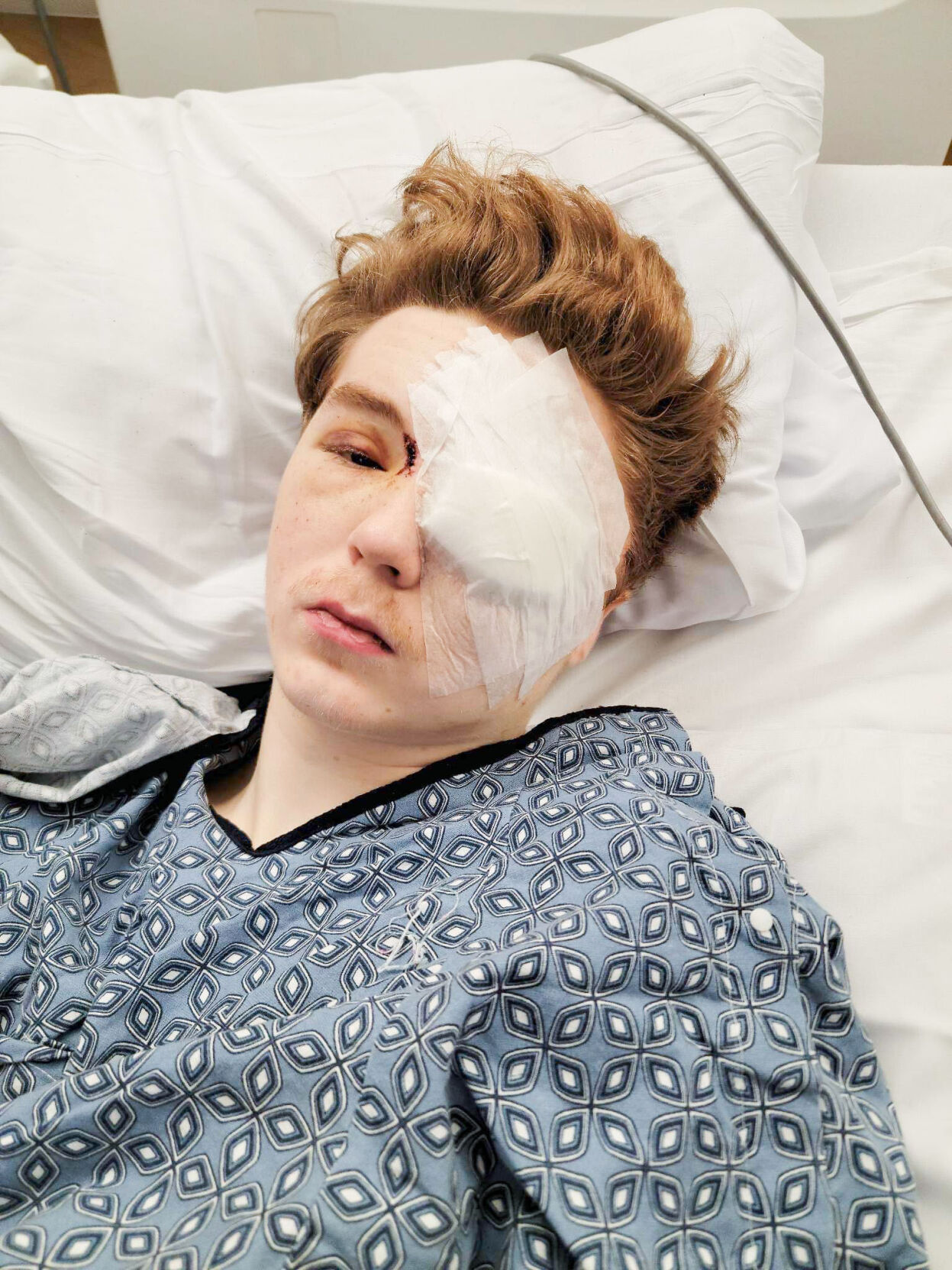 ‘It’s a miracle’ Dadeville teen survives gunshot to face