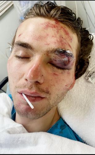 Quinn guilty of resisting arrest; former deputy federally indicted in ‘stomping’ incident