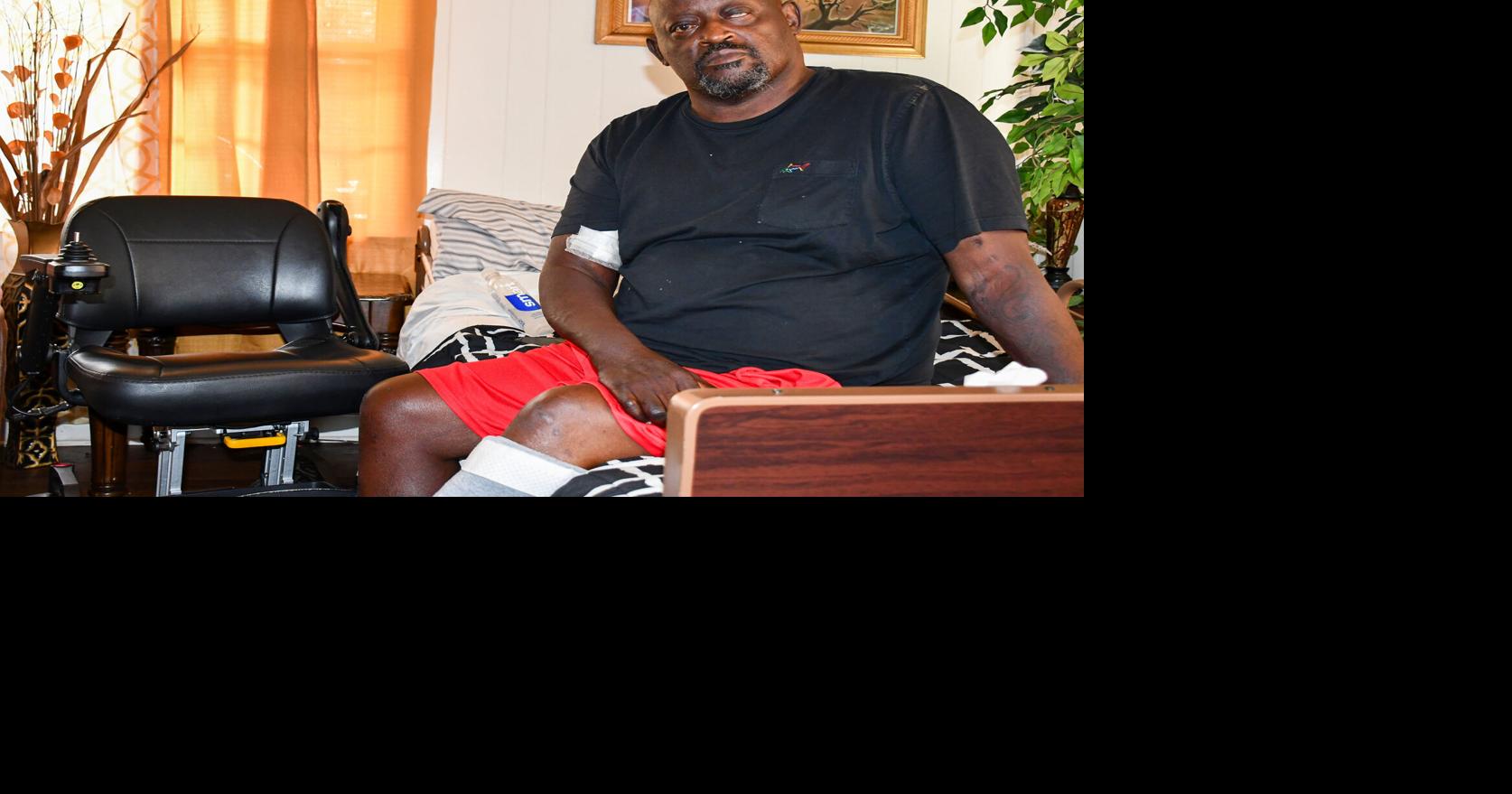 Resident fights battle against unknown assailant