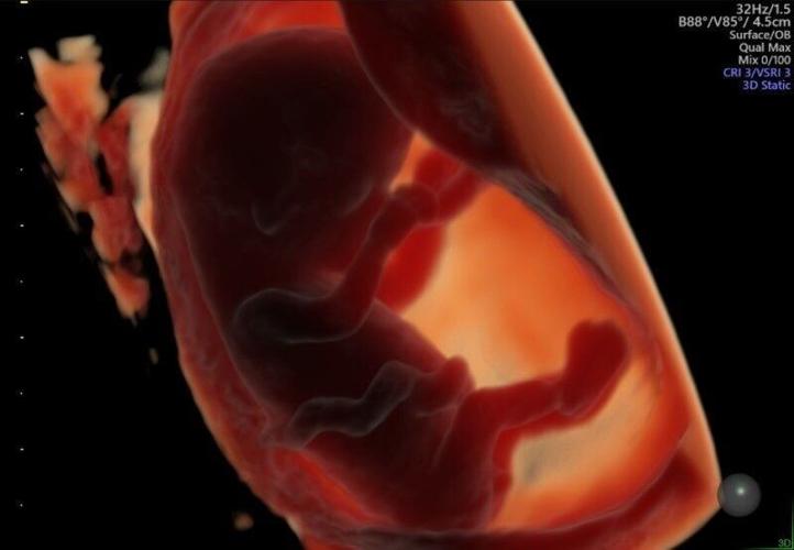 Men who eat bacon and sausages will find it harder to father a baby, suggests study