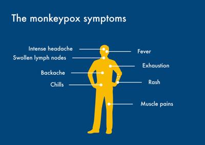 Monkeypox cases in Alabama now up to 21