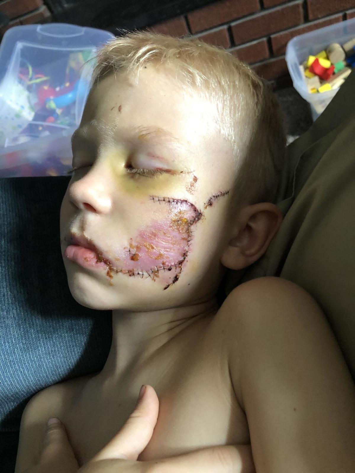Cheyenne Boy Goes Viral After Protecting Sister From Dog Attack Wyoming News Trib Com