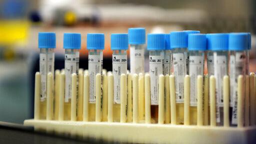 Health Department announces 16th coronavirus-related death in Wyoming - Casper Star-Tribune