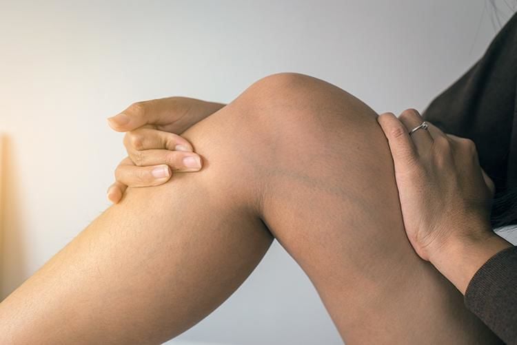 Varicose veins