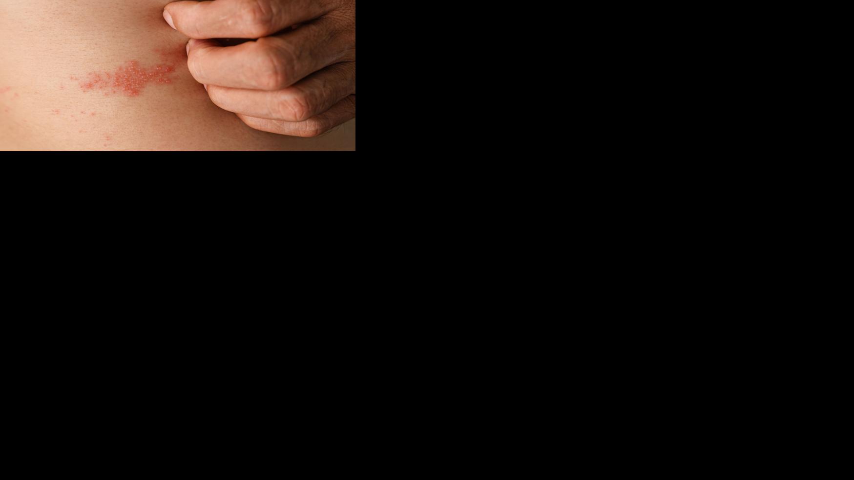 Asset-image