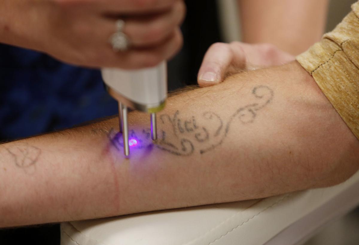 Armed With A Laser Casper Skin Care Clinic Offers People A Clean Start Casper Trib Com