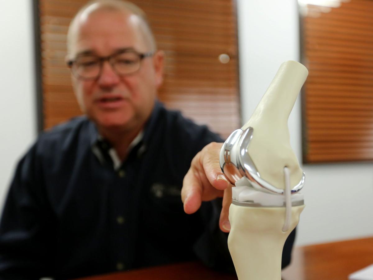 Casper surgeon among first in U.S. to replace knees created with 3D ... - 579a47eb9028c.image