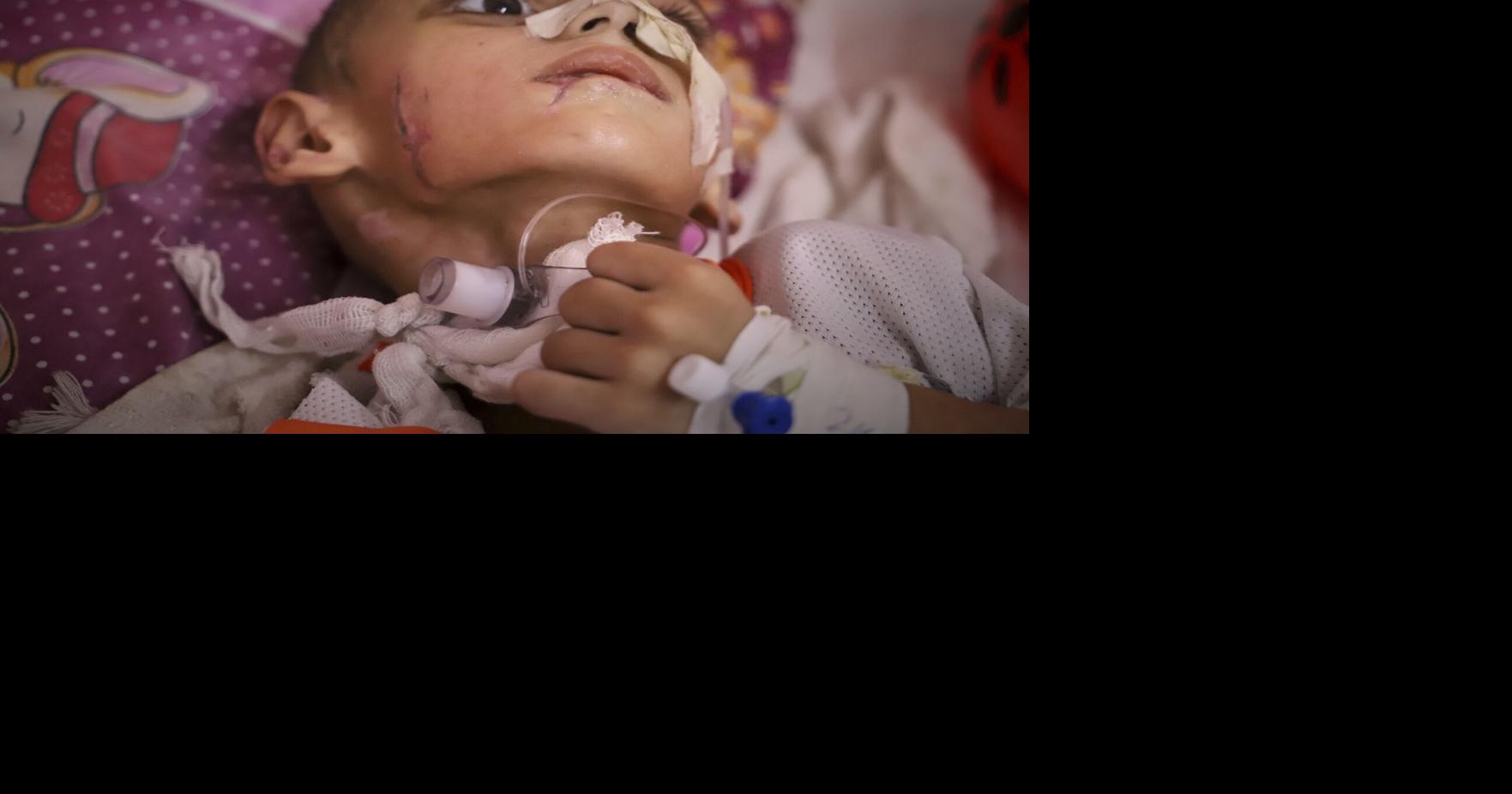 'What can they do for him?': Boy with a brain injury fights for his life in Gaza's decimated health system
