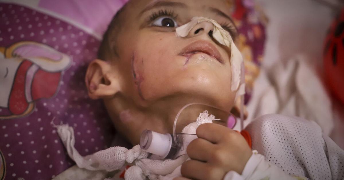 'What can they do for him?': Boy with a brain injury fights for his life in Gaza's decimated health system
