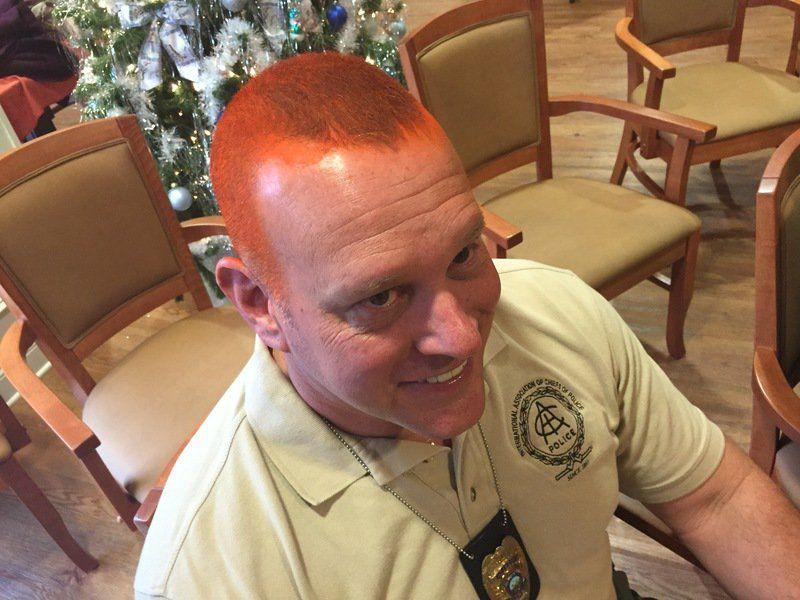 Fundraiser Tops 10k Goal 8 Community Members Dye Hair Orange