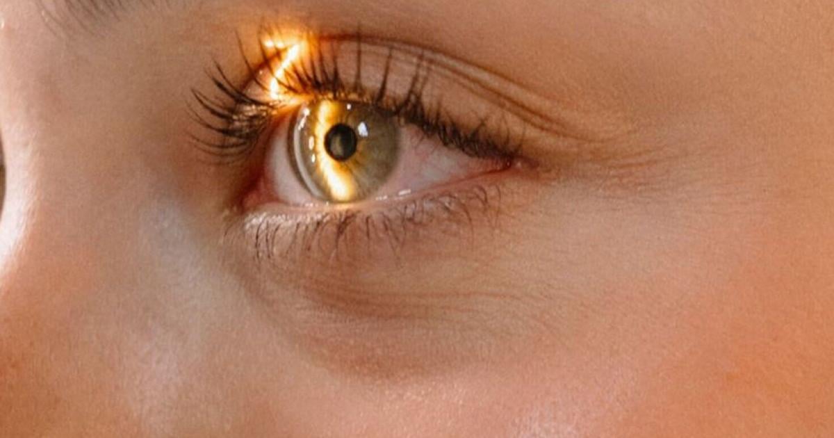 Statin users less likely to need stronger treatment for glaucoma